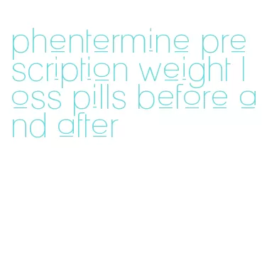 phentermine prescription weight loss pills before and after