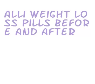 alli weight loss pills before and after