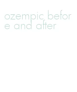 ozempic before and after