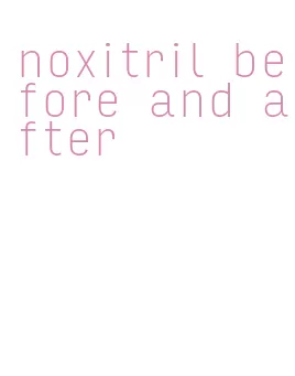 noxitril before and after