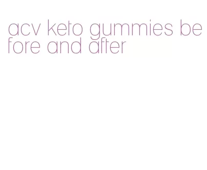 acv keto gummies before and after