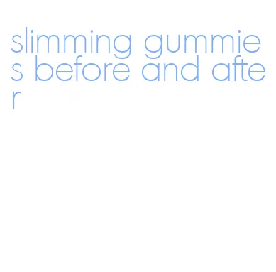 slimming gummies before and after