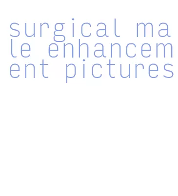 surgical male enhancement pictures