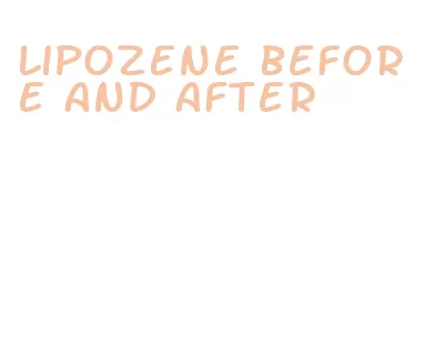 lipozene before and after