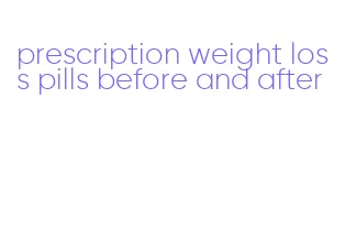 prescription weight loss pills before and after