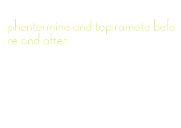 phentermine and topiramate before and after