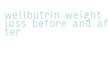 wellbutrin weight loss before and after