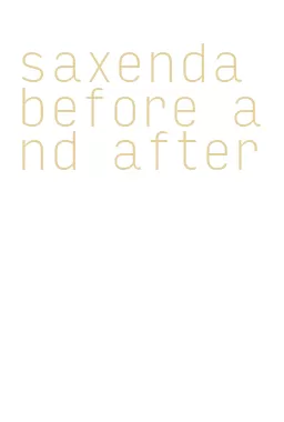 saxenda before and after