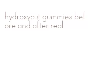 hydroxycut gummies before and after real