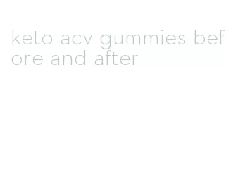 keto acv gummies before and after