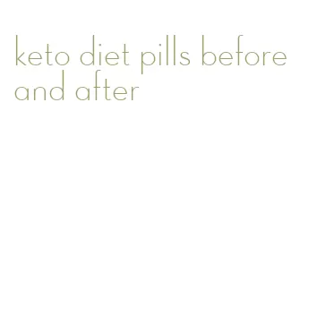 keto diet pills before and after