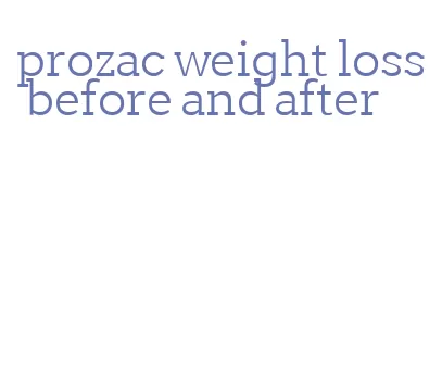 prozac weight loss before and after