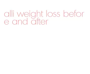 alli weight loss before and after