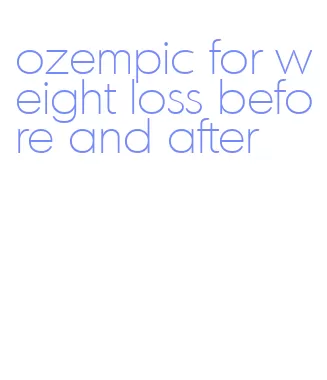 ozempic for weight loss before and after