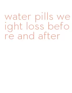 water pills weight loss before and after