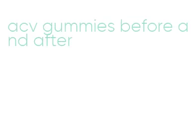 acv gummies before and after