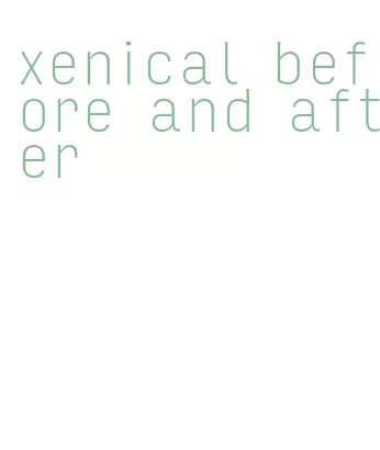 xenical before and after