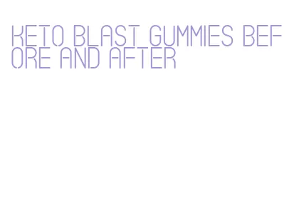 keto blast gummies before and after