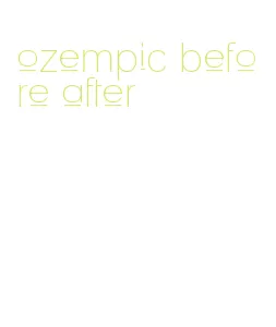 ozempic before after