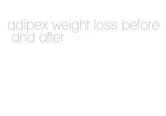 adipex weight loss before and after