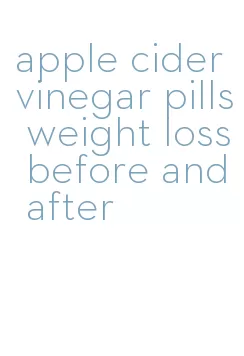 apple cider vinegar pills weight loss before and after