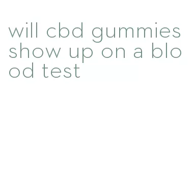 will cbd gummies show up on a blood test