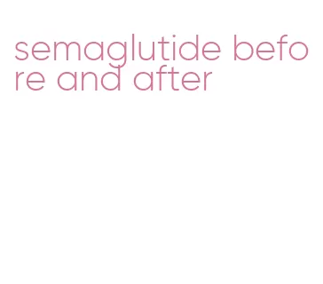 semaglutide before and after