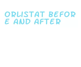 orlistat before and after