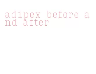 adipex before and after