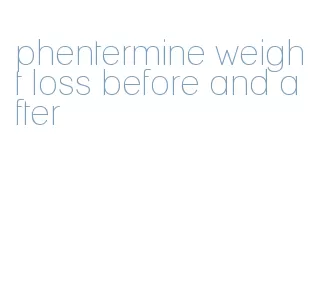 phentermine weight loss before and after