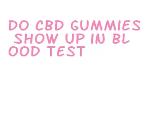 do cbd gummies show up in blood test