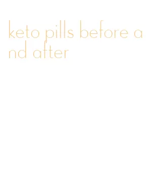 keto pills before and after