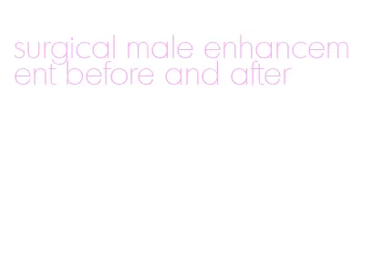 surgical male enhancement before and after