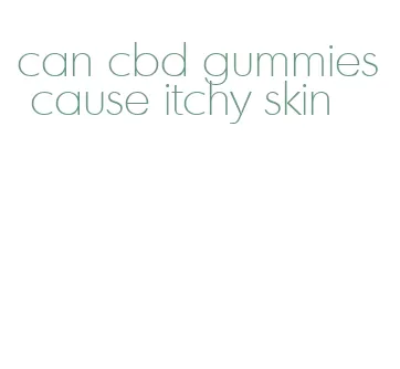 can cbd gummies cause itchy skin