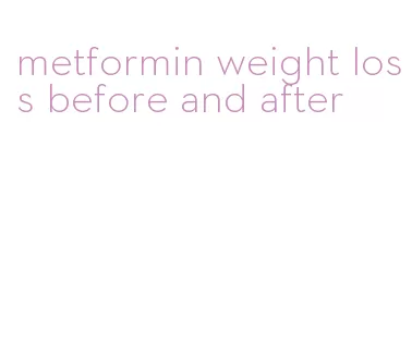 metformin weight loss before and after