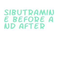 sibutramine before and after