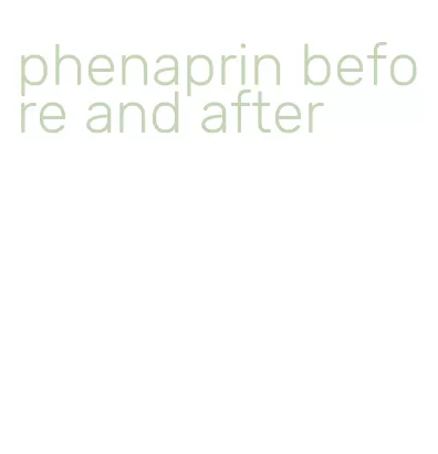 phenaprin before and after