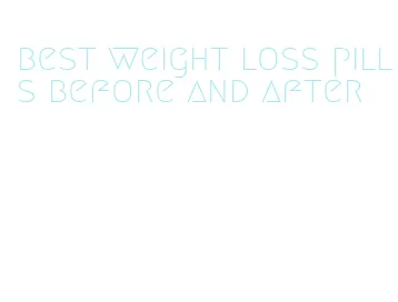 best weight loss pills before and after