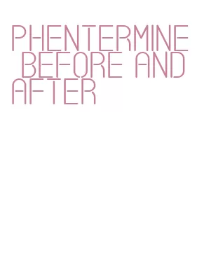 phentermine before and after