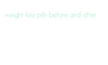 weight loss pills before and after