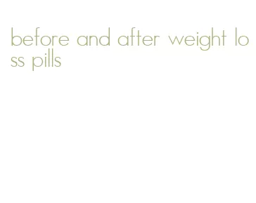 before and after weight loss pills