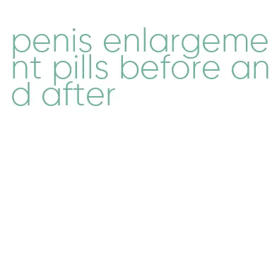 penis enlargement pills before and after