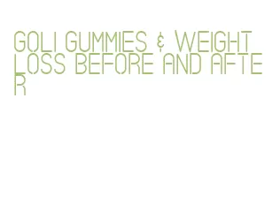 goli gummies & weight loss before and after