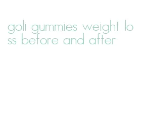 goli gummies weight loss before and after