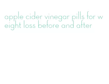 apple cider vinegar pills for weight loss before and after