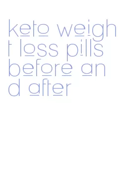 keto weight loss pills before and after