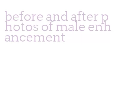 before and after photos of male enhancement