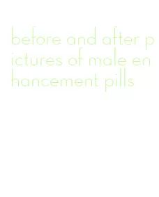 before and after pictures of male enhancement pills