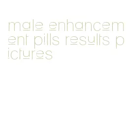 male enhancement pills results pictures